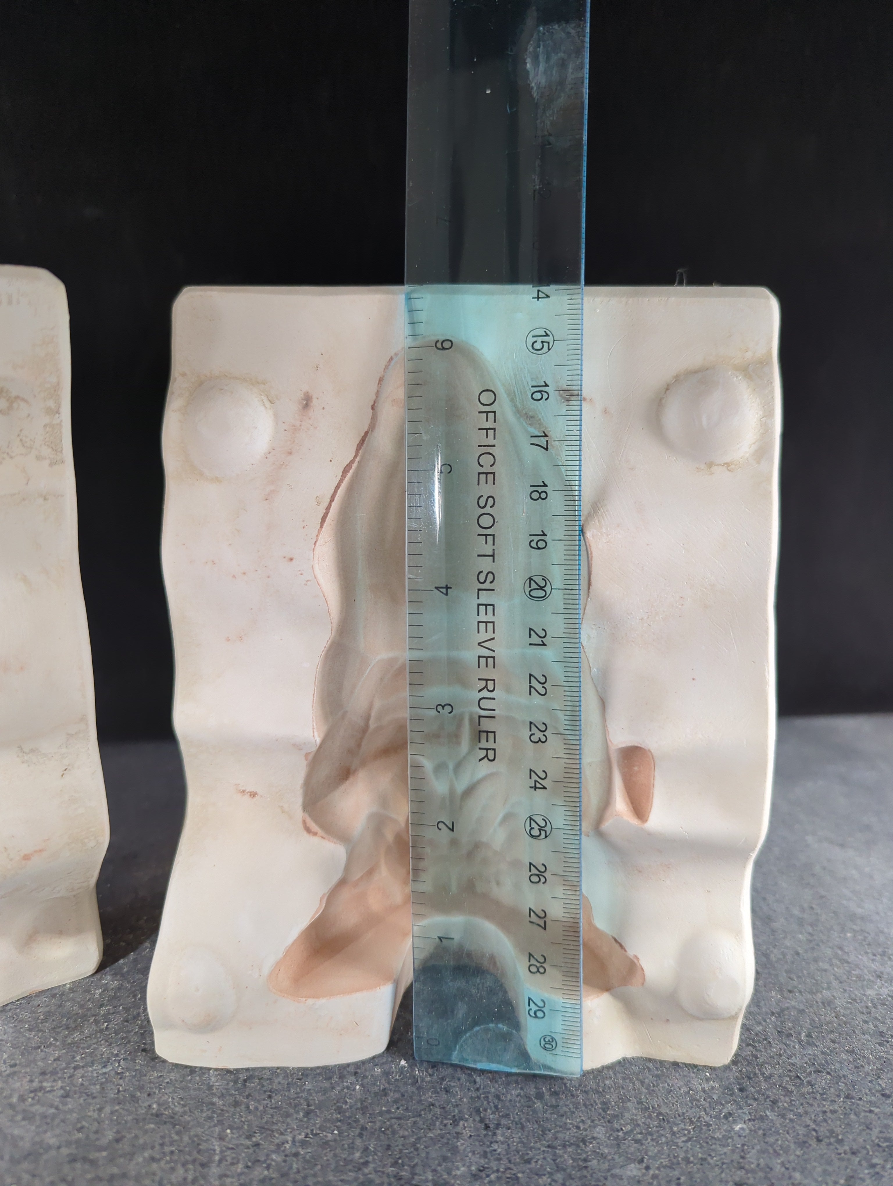 CM00196 - A-36 Alberta's Gnome W/ Watering Can