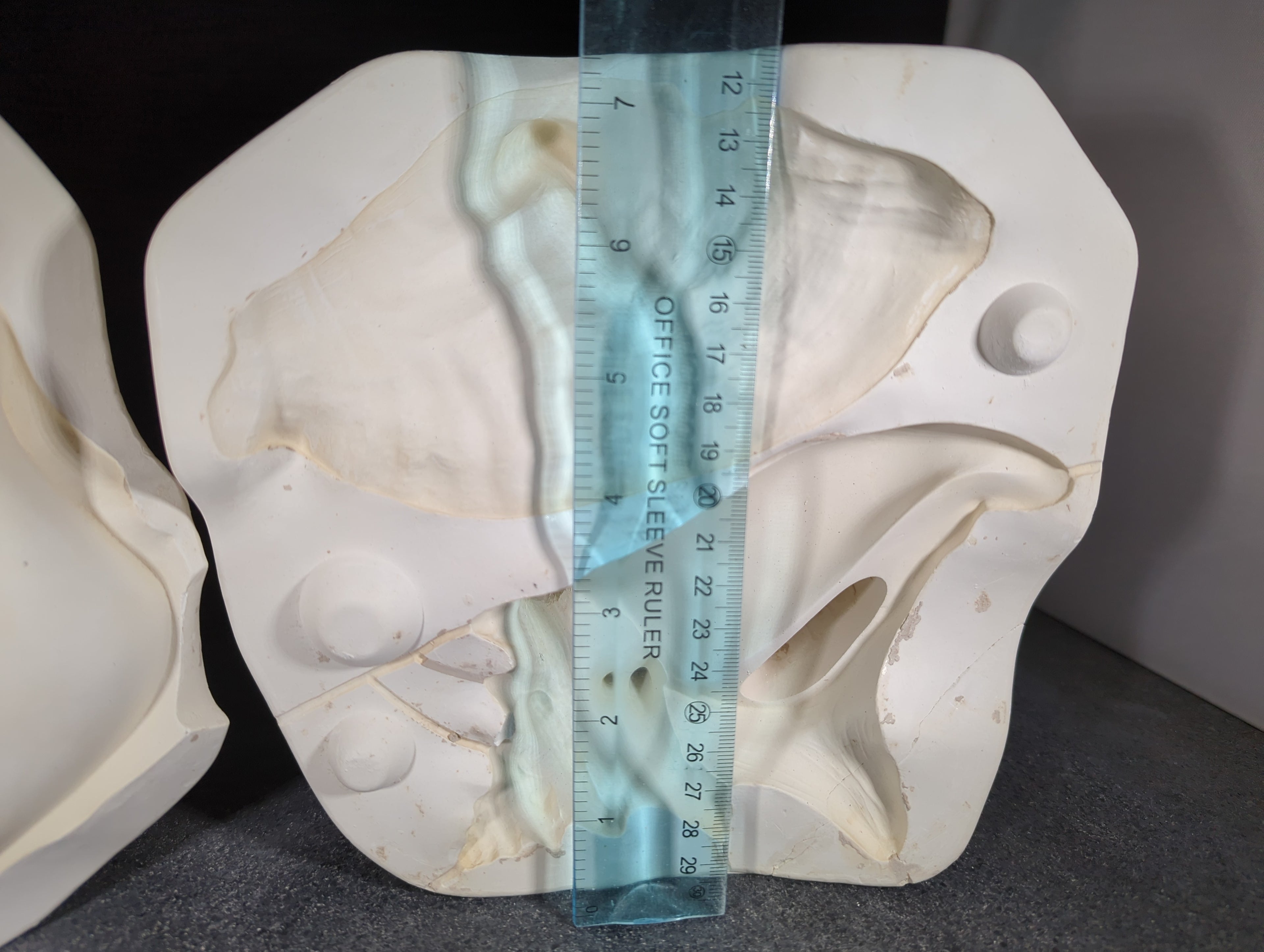 CM0151 - DM 473 Duncan Conch Shell